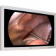 Foreseeson FS-L5501D 55" LCD Touchscreen Monitor - 16:9 - 9 ms - 1920 x 1080 - Full HD - 1.06 Billion Colors - 1,300:1 - 450 Nit - DVI - VGA FS-L5501D