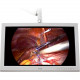 Foreseeson FS-P2603D 26" Full HD LED LCD Monitor - 16:9 - 1920 x 1080 - 450 Nit - 8 ms - DVI - VGA FS-P2603D